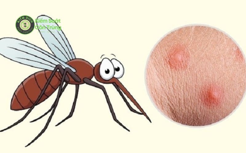 Bị muỗi đốt có nên bôi dầu gió không? 5 Cách đuổi muỗi tốt Muỗi đọt sưng to